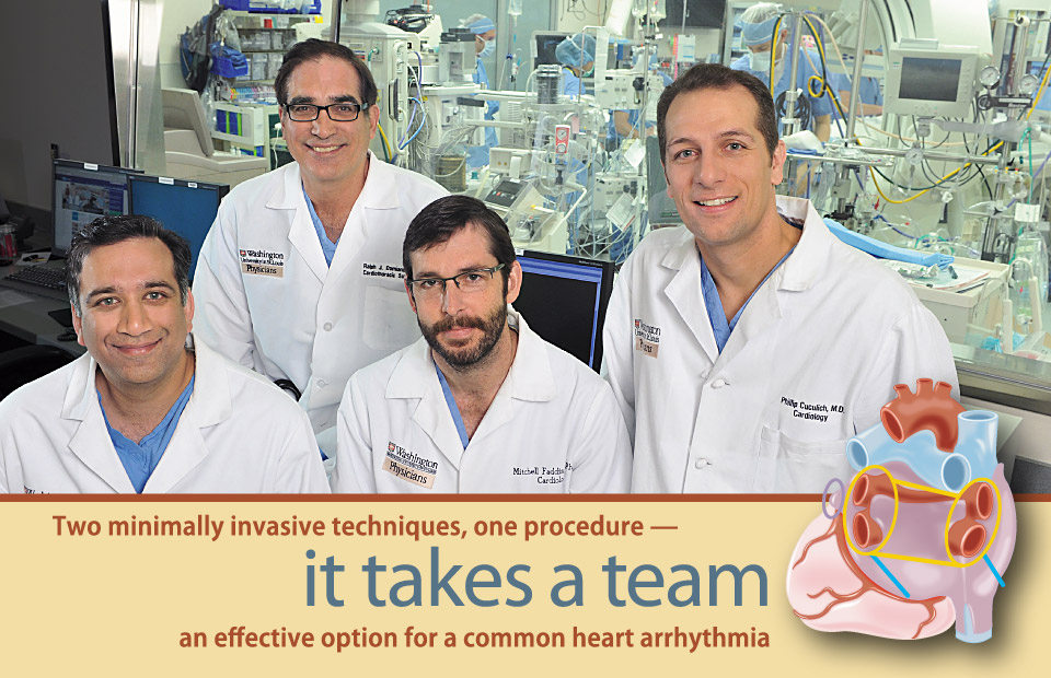 Hersh Maniar, MD, Ralph Damiano Jr, MD, Mitch Faddis, MD, PhD, and Phil Cuculich, MD, are specialists with the Washington University and Barnes-Jewish Heart & Vascular Center who treat patients with atrial fibrillation.