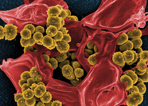 Scanning electron micrograph of methicillin-resistant Staphylococcus aureus (MRSA). 