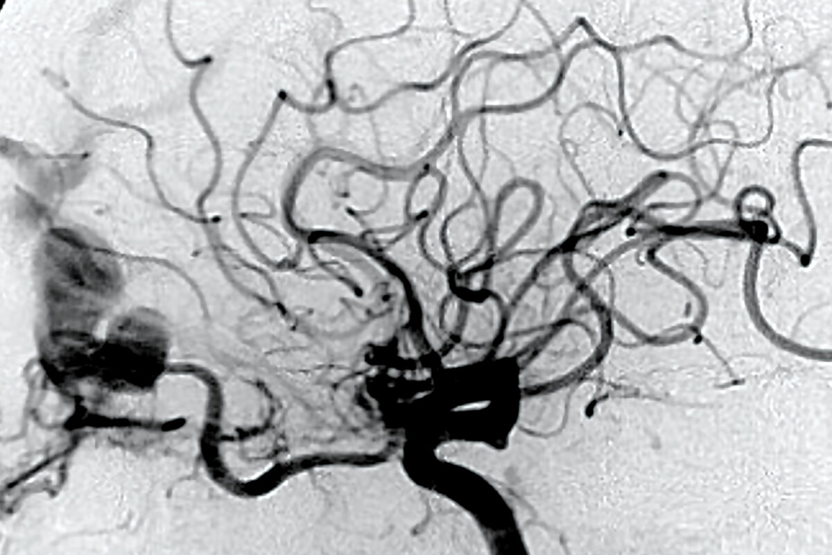 Photo of an angiogram. 