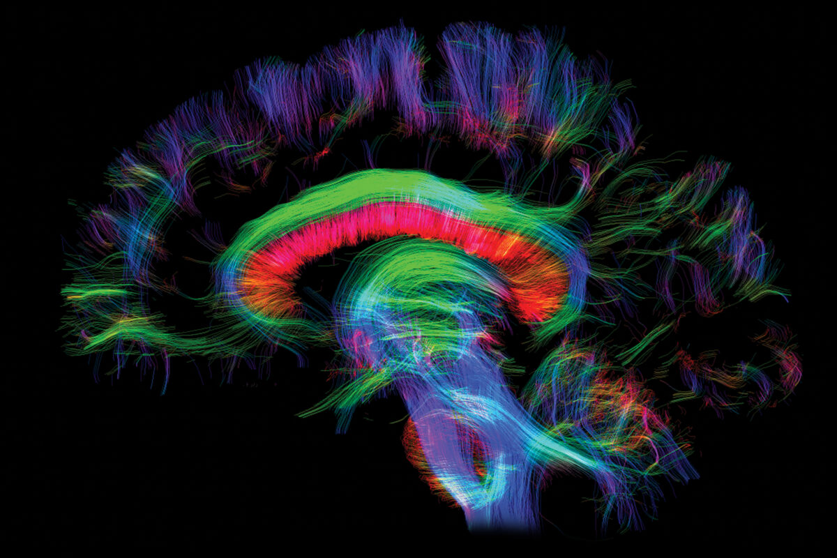 Human development brain image
